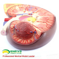 KIDNEY02(12431) Oversize Plastic Kidney with Stand 3 Time Enlarge Life Size Medical Anatomy